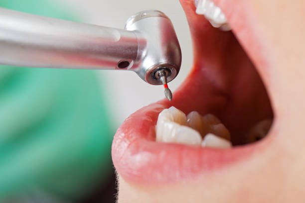 Best Dentist for Dental Trauma  in Thermal, CA